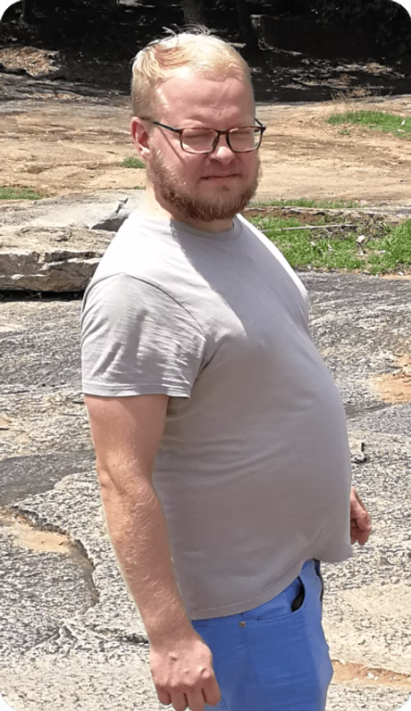 Before transformation